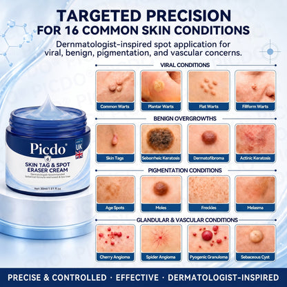 𝐏𝐢𝐜𝐝𝐨® 🧑‍⚕️ 7-𝐃𝐚𝐲 𝐒𝐤𝐢𝐧 𝐓𝐚𝐠 & 𝐒𝐩𝐨𝐭 𝐄𝐫𝐚𝐬𝐞𝐫 𝐂𝐫𝐞𝐚𝐦(Zero Pain, Zero 𝐒𝐜𝐚𝐫𝐬 Formula) 💦
