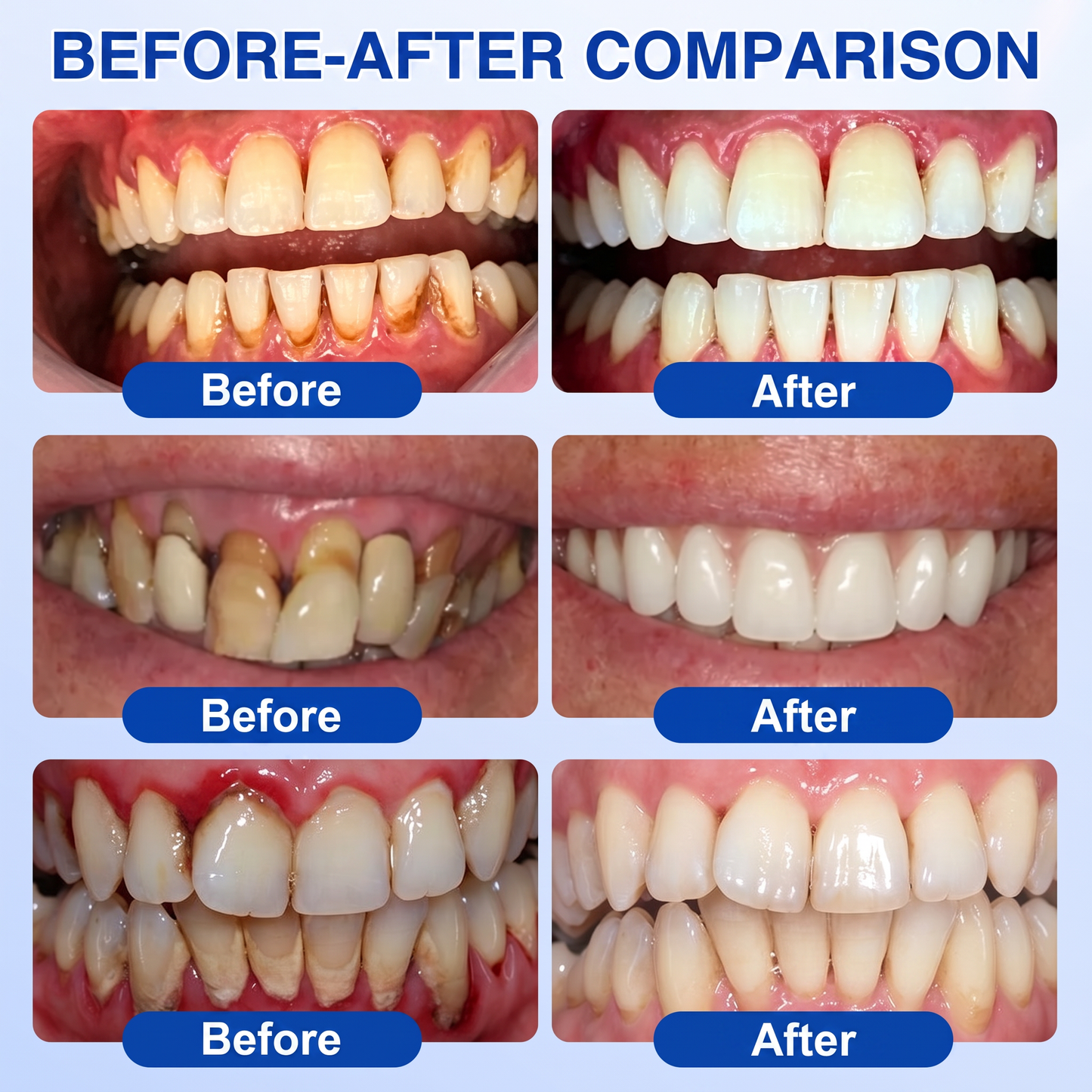 🇬🇧Glimmerly® 🦷 GumRevive periodontal repair gel 🧑‍⚕️