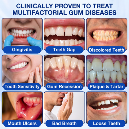 🇬🇧Glimmerly® 🦷 GumRevive periodontal repair gel 🧑‍⚕️