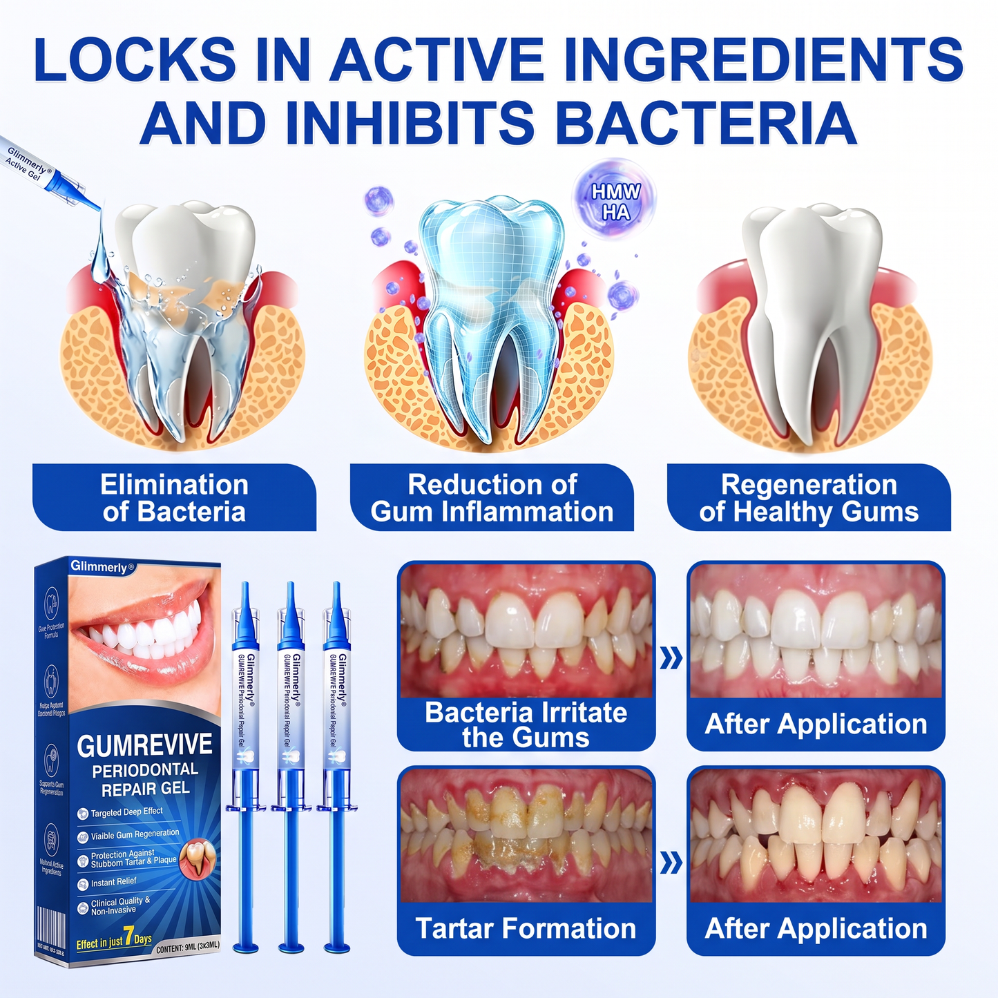 🇬🇧Glimmerly® 🦷 GumRevive periodontal repair gel 🧑‍⚕️