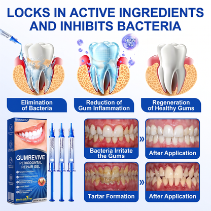 🇬🇧Glimmerly® 🦷 GumRevive periodontal repair gel 🧑‍⚕️